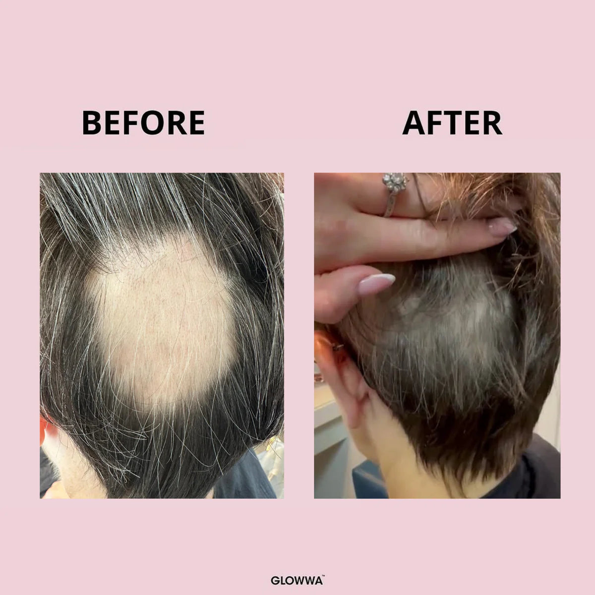 GLOWWA- Hair food Original