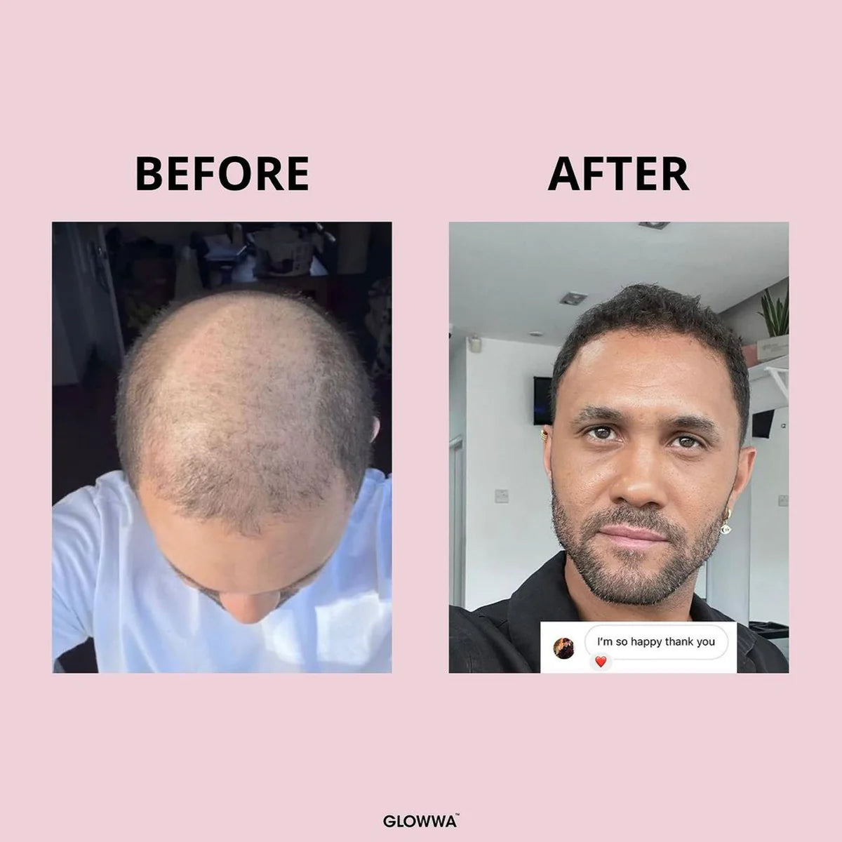 GLOWWA- Hair food Original